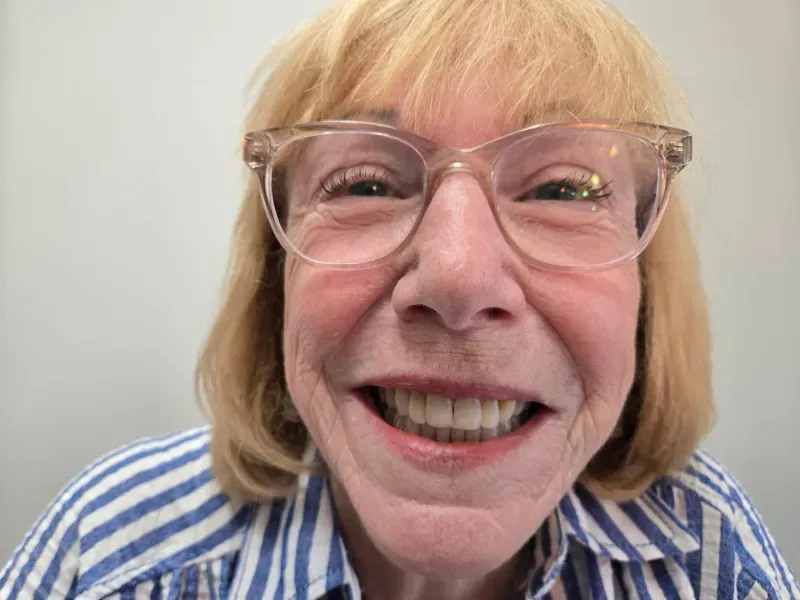 Janell after clear aligner treatment
